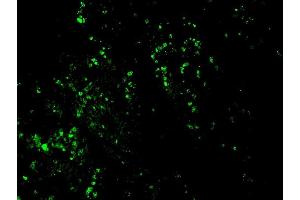 Formalin-fixed, paraffin-embedded human colon carcinoma stained with CF488-conjugated Nucleolin MAb (364-5 + NCL/902). (BrdU antibody  (CF®488A))