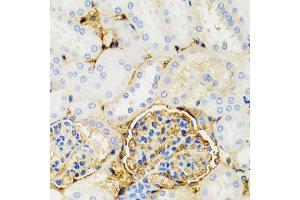 Immunohistochemistry of paraffin-embedded mouse kidney using GALT antibody. (GALT antibody)