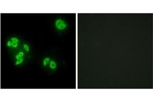 Immunofluorescence analysis of A549 cells, using TFIP8 Antibody  . (TNFAIP8 antibody)