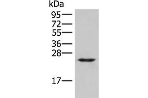 Western blot analysis of Human fetal brain tissue lysate using MRAS Polyclonal Antibody at dilution of 1:400 (MRAS antibody)