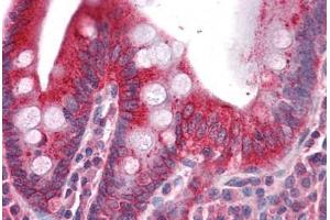 Human Small Intestine: Formalin-Fixed, Paraffin-Embedded (FFPE) (DR3/LARD antibody  (AA 1-210))