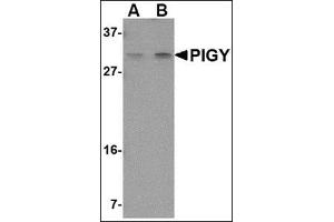 Western blot analysis of PIG-Y in human spleen tissue lysate with this product at (A) 1 and (B) 2 μg/ml. (PIGY antibody  (Center))