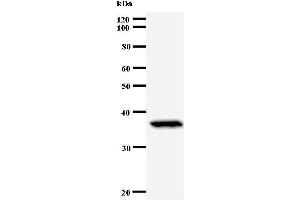 Western Blotting (WB) image for anti-Paired Box 6 (PAX6) antibody (ABIN930925) (PAX6 antibody)