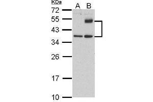 WB Image Sample (30 ug of whole cell lysate) A: HeLa (control)  B: HeLa treat tunicamycin (4ug/ml) 12% SDS PAGE antibody diluted at 1:500 (ATF4 antibody)