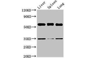 Western Blot Positive WB detected in: Mouse liver tissue, Mouse spleen tissue, Mouse lung tissue All lanes: Gba antibody at 3. (GBA antibody  (AA 20-515))
