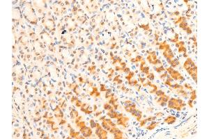 Immunohistochemistry (IHC) image for anti-Forkhead Box O3 (FOXO3) (pSer253) antibody (ABIN6255131)
