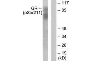 Western blot analysis of extracts from HeLa cells treated with Heat shock, using GR (Phospho-Ser211) Antibody. (GR (AA 181-230), (pSer211) antibody)