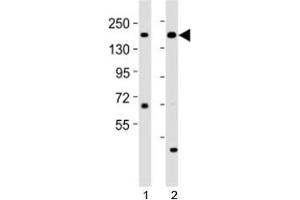 Western blot testing of Kdm6a antibody at 1:2000 dilution. (KDM6A antibody  (C-Term))
