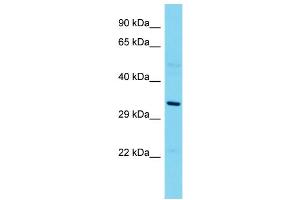 Host: Rabbit  Target Name: Eapp  Sample Tissue: Rat Thymus lysates  Antibody Dilution: 1. (EAPP antibody  (N-Term))