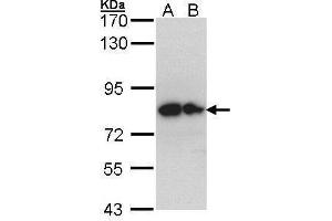 WB Image Sample (30 ug of whole cell lysate) A: Hep G2 , B: Molt-4 , 7. (GPC1 antibody)