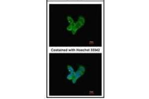 Immunofluorescence analysis of methanol-fixed HepG2, using Complement C9 antibody at 1/200 dilution. (C9 antibody)