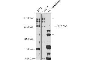Western blot analysis of extracts of various cell lines, using SLC12 antibody (ABIN7270399) at 1:3000 dilution. (SLC12A3 antibody)