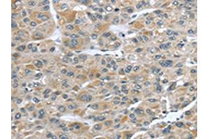 CCDC19 antibody