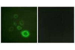 Immunofluorescence analysis of A549 cells, using c-Met (Ab-1003) antibody. (c-MET antibody  (Tyr1003))