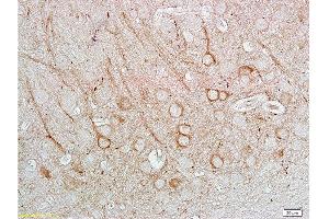 Immunohistochemistry (Paraffin-embedded Sections) (IHC (p)) image for anti-Nitric Oxide Synthase 1, Neuronal (NOS1) (AA 51-150) antibody (ABIN725585) (NOS1 antibody  (AA 51-150))
