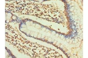 Immunohistochemistry of paraffin-embedded human small intestine tissue using ABIN7148198 at dilution of 1:100