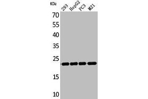Western Blot analysis of 293 HepG2 PC-3 M21 cells using FGF-6 Polyclonal Antibody (FGF6 antibody  (C-Term))