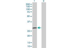 Western Blot analysis of SPSB2 expression in transfected 293T cell line by SPSB2 MaxPab polyclonal antibody. (SPSB2 antibody  (AA 1-263))