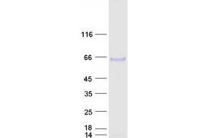 Arylsulfatase B Protein (ARSB) (Transcript Variant 1) (Myc-DYKDDDDK Tag)