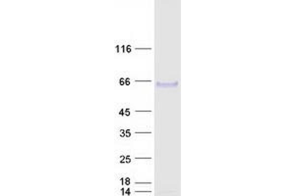 Arylsulfatase B Protein (ARSB) (Transcript Variant 1) (Myc-DYKDDDDK Tag)