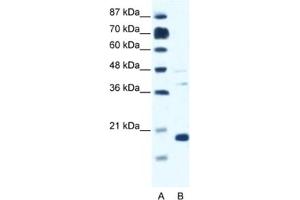 Western Blotting (WB) image for anti-Calcium Channel, Voltage-Dependent, gamma Subunit 1 (CACNG1) antibody (ABIN2461569) (CACNG1 antibody)