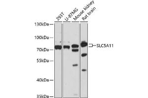 Western blot analysis of extracts of various cell lines, using SLC5 antibody (ABIN6127283, ABIN6148021, ABIN6148022 and ABIN6217058) at 1:3000 dilution. (Solute Carrier Family 5 (Sodium/inositol Cotransporter), Member 11 (SLC5A11) (AA 540-640) antibody)