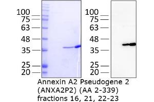 Quality Control Images: Western Blotting + SDS-PAGE (ANXA2P2 Protein (AA 2-339) (His tag))