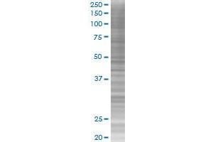 ARNT transfected lysate. (ARNT 293T Cell Transient Overexpression Lysate(Denatured))