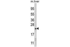 Western blot analysis of NQO2 Antibody (Center) in mouse liver tissue lysates (35ug/lane). (NQO2 antibody  (Middle Region))