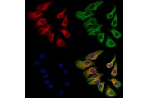 ABIN6263049 and ABIN6273132 staining Hela cells by IF/ICC. (MAD2L2 antibody  (Internal Region))