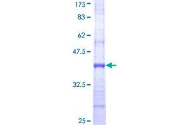 SLC15A1 Protein (AA 473-572) (GST tag)