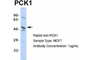 Western Blotting (WB) image for anti-phosphoenolpyruvate Carboxykinase 1 (Soluble) (PCK1) (Middle Region) antibody (ABIN2777602)
