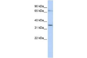 Western Blotting (WB) image for anti-Solute Carrier Organic Anion Transporter Family, Member 1C1 (SLCO1C1) antibody (ABIN2458796) (SLCO1C1 antibody)