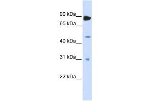 ADARB1 antibody used at 1 ug/ml to detect target protein.