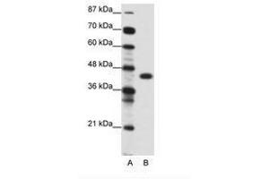 Image no. 1 for anti-Zinc Finger Protein 396 (ZNF396) (AA 181-230) antibody (ABIN6736117)