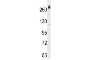 Western Blotting (WB) image for anti-Carbamoyl-Phosphate Synthetase 2, Aspartate Transcarbamylase, and Dihydroorotase (CAD) (AA 780-809) antibody (ABIN3030276)