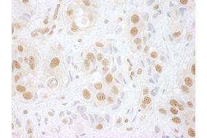 Immunohistochemistry (IHC) image for anti-hPrp3p (AA 100-150) antibody (ABIN7448600) (hPrp3p (AA 100-150) antibody)