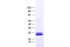Validation with Western Blot (GUCA1B Protein (His tag))