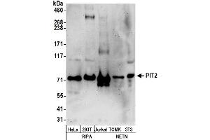 anti-Solute Carrier Family 20 (Phosphate Transporter), Member 2 (SLC20A2) (AA 300-350) antibody