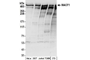 anti-Microtubule-Actin Crosslinking Factor 1 (MACF1) (AA 1975-2025) antibody