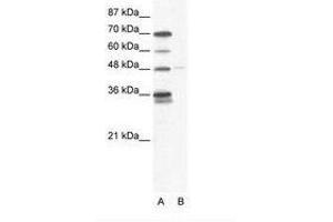 Image no. 1 for anti-GLIS Family Zinc Finger 2 (GLIS2) (AA 83-132) antibody (ABIN202714) (GLIS2 antibody  (AA 83-132))