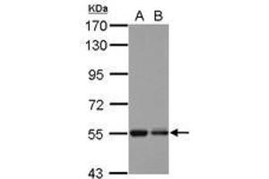 Image no. 1 for anti-Kelch Repeat and BTB (POZ) Domain Containing 4 (KBTBD4) (AA 287-518) antibody (ABIN1501896) (KBTBD4 antibody  (AA 287-518))