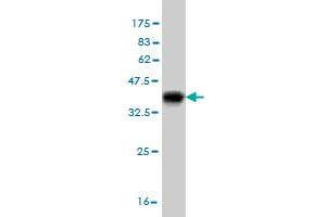 Western Blot detection against Immunogen (36. (ACBD3 antibody  (AA 73-171))