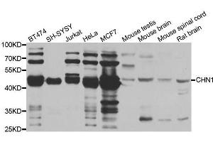 Western blot analysis of extracts of various cell lines, using CHN1 antibody. (CHN1 antibody  (AA 1-200))
