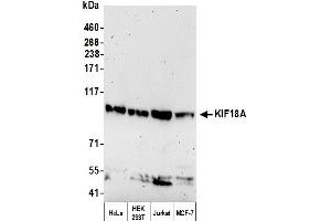 Western Blotting (WB) image for anti-Kinesin Family Member 18A (KIF18A) (C-Term) antibody (ABIN7450393)