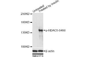 Western blot analysis of extracts of NIH/3T3 cells, using Phospho-HDAC5-S498 antibody (ABIN2987596) at 1/2000 dilution. (HDAC5 antibody  (pSer498))