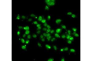 Immunofluorescence analysis of A-549 cells using WBSCR22 antibody (ABIN6132946, ABIN6150175, ABIN6150176 and ABIN6223157). (WBSCR22 antibody  (AA 1-281))