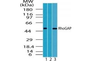 Image no. 1 for anti-rho GTPase Activating Protein 1 (ARHGAP1) (AA 1-50) antibody (ABIN207682) (ARHGAP1 antibody  (AA 1-50))