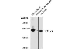 Western blot analysis of extracts of various cell lines, using LRRFIP2 Rabbit pAb (ABIN7268214) at 1:1000 dilution. (LRRFIP2 antibody  (AA 150-340))