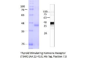 Image no. 2 for Thyroid Stimulating Hormone Receptor (TSHR) (AA 22-413) protein (His tag) (ABIN3134134) (TSH receptor Protein (AA 22-413) (His tag))